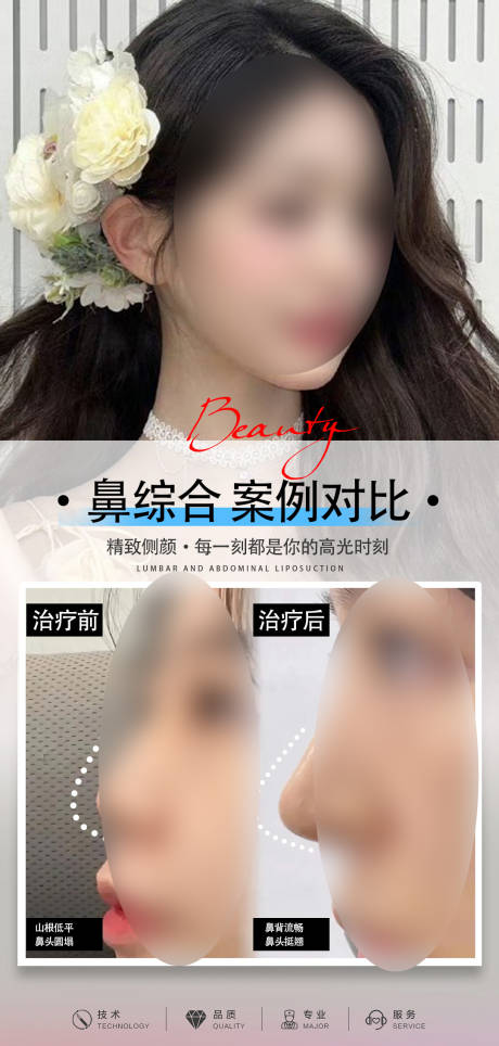 源文件下载【鼻子案例海报】编号：44060031860309468
