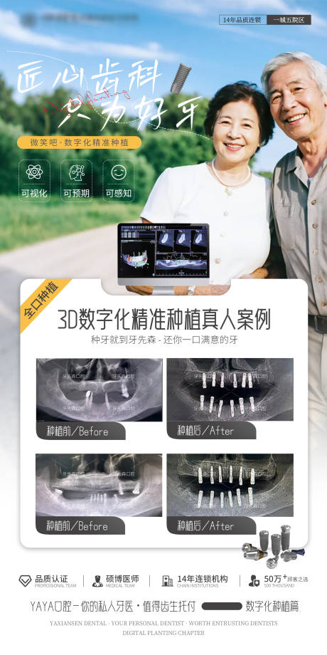 源文件下载【享设计】搜索编号：60770031958861514【种植牙案例海报】