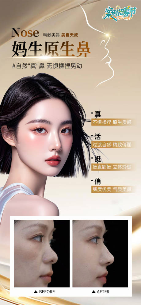 源文件下载【隆鼻】编号：39560032099196152