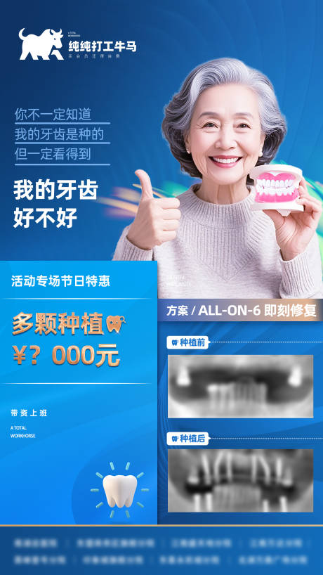 源文件下载【享设计】搜索编号：45470032235229585【口腔种植牙案例专场海报】
