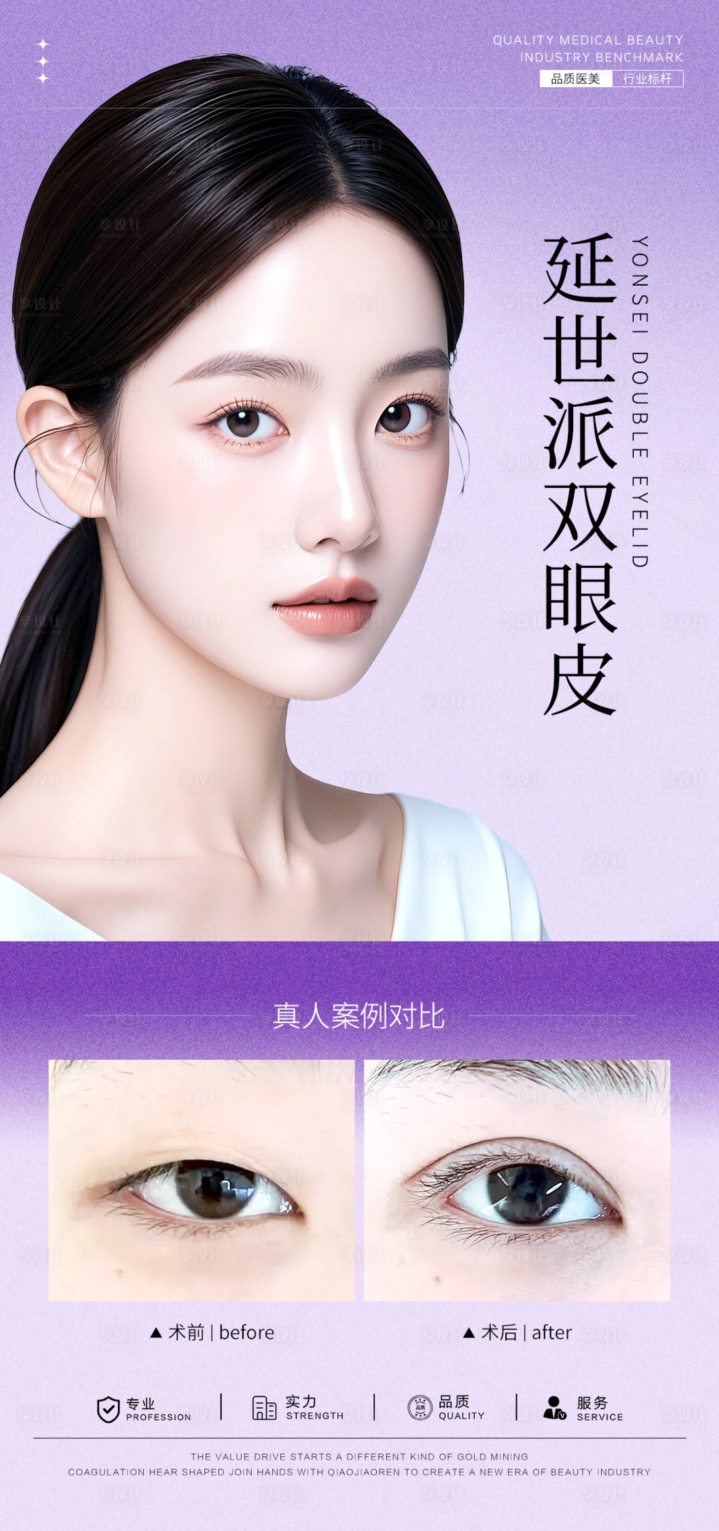 源文件下載【享設計】搜索編號：80770032119166115【雙眼皮案例海報】