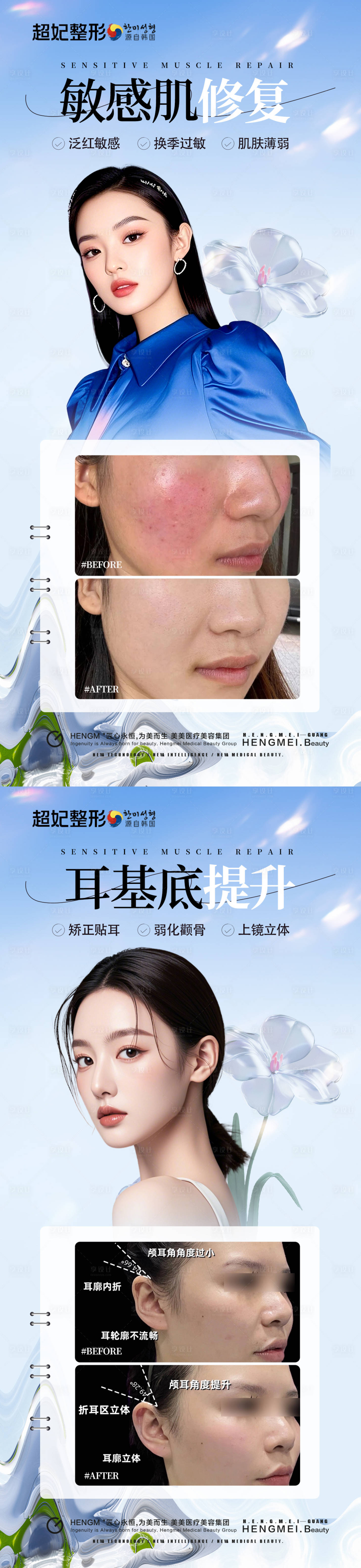 源文件下載【享設計】搜索編號：88260031770796067【醫美案例海報】