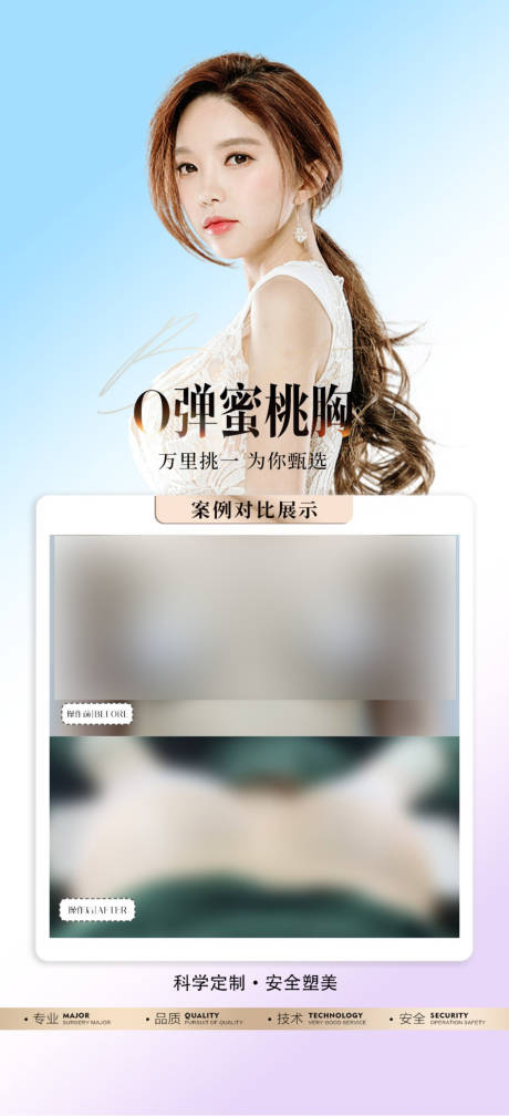 源文件下载【隆胸案例】编号：14120031725641300
