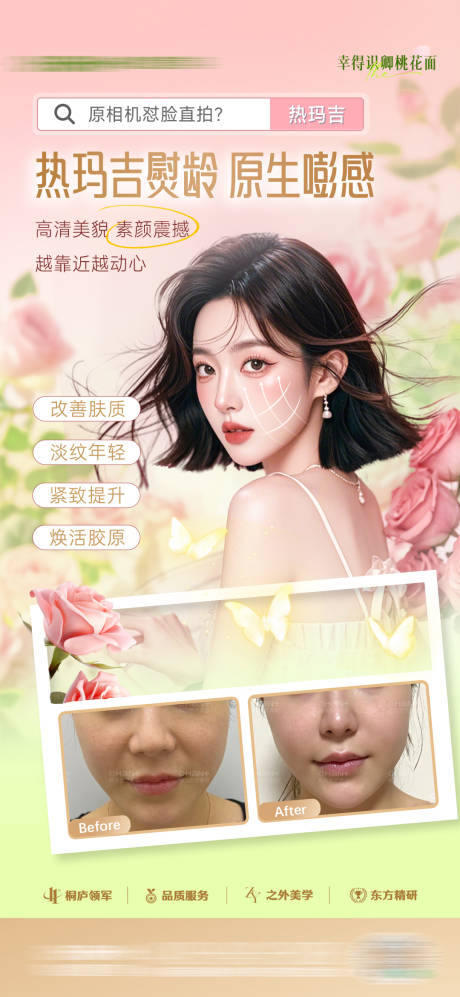 源文件下載【享設計】搜索編號：98710031703446722【醫美熱瑪吉案例宣傳海報】
