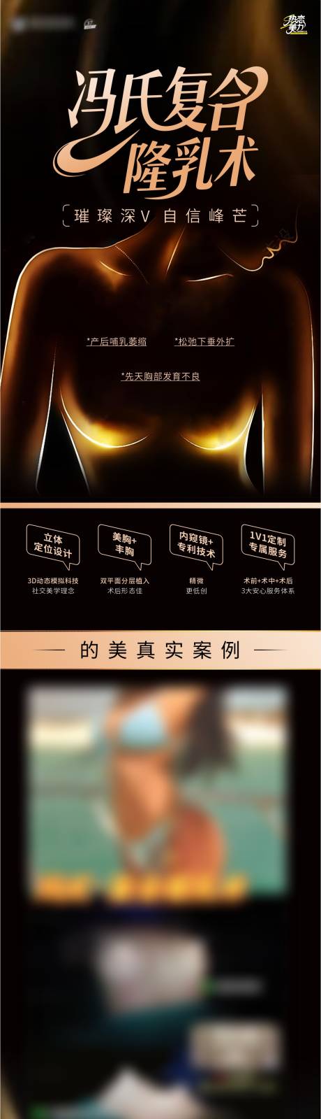源文件下载【丰胸医美海报】编号：38520031912586011