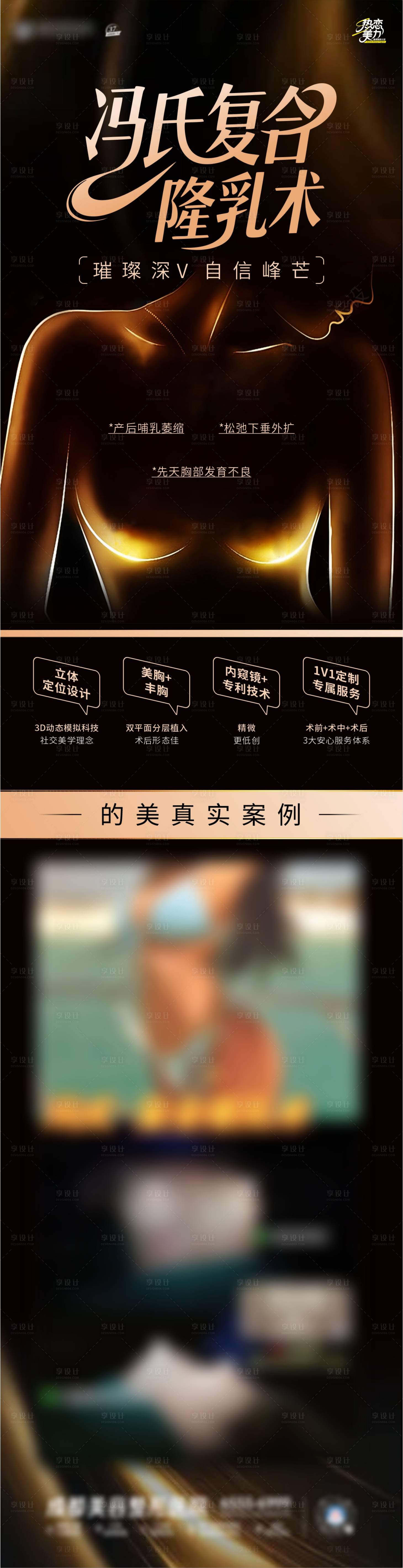 源文件下載【享設(shè)計(jì)】搜索編號：38520031912586011【豐胸醫(yī)美海報】