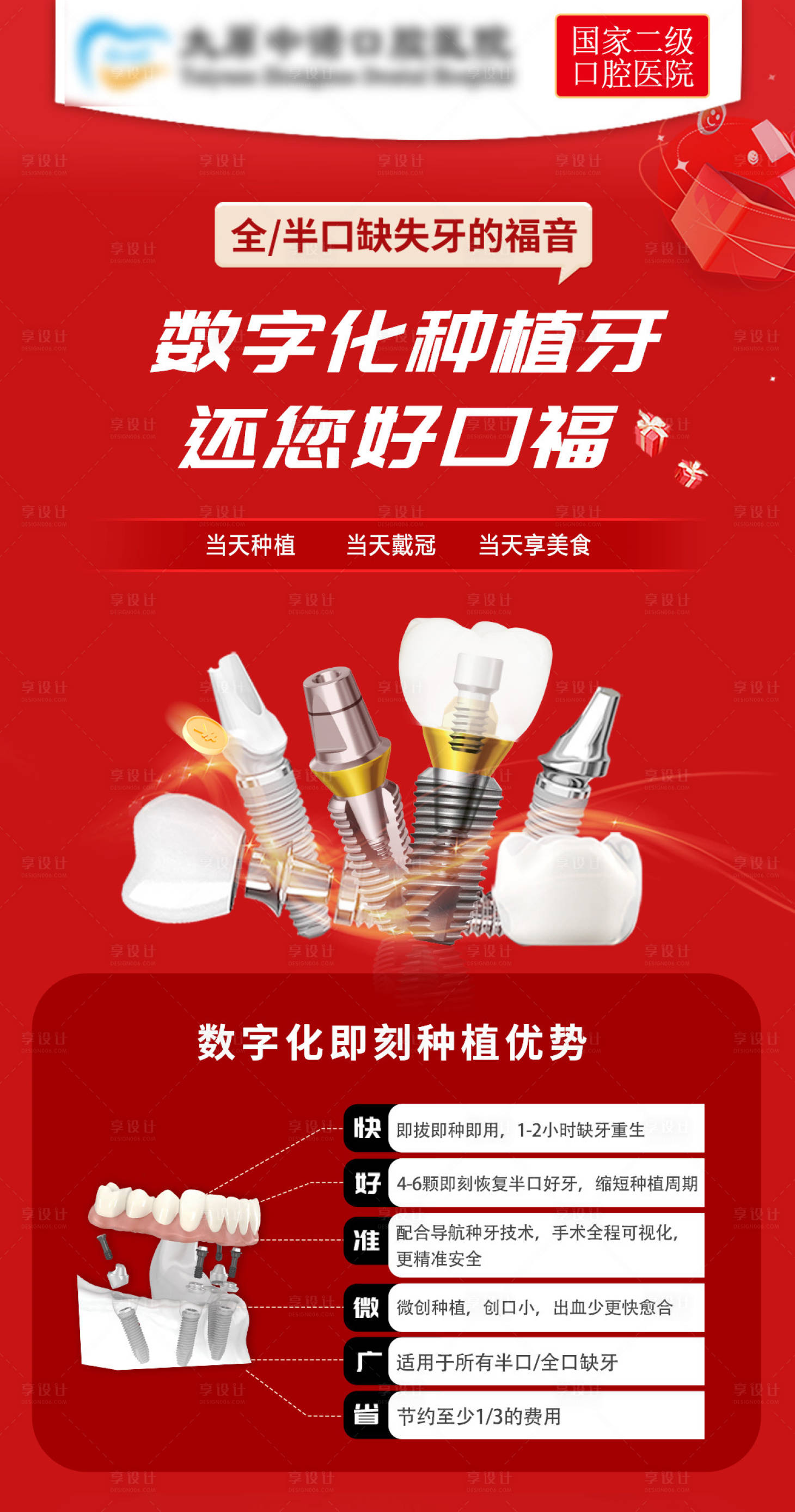 源文件下載【享設(shè)計】搜索編號：50010029834191925【數(shù)字化種植牙】