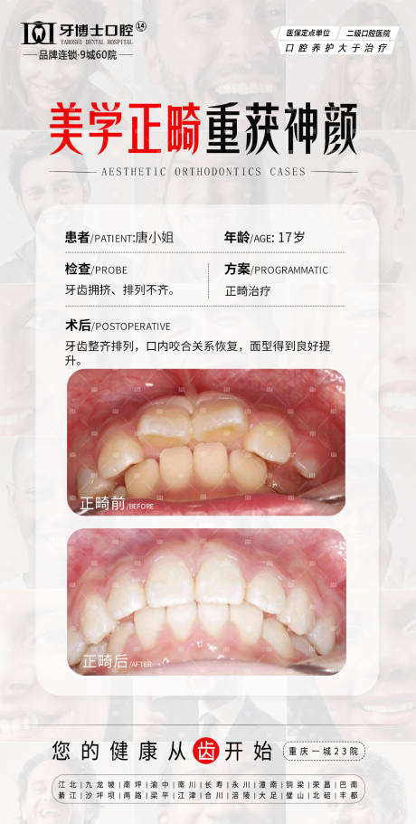 源文件下载【享设计】搜索编号：68280032236416900【正畸案例】