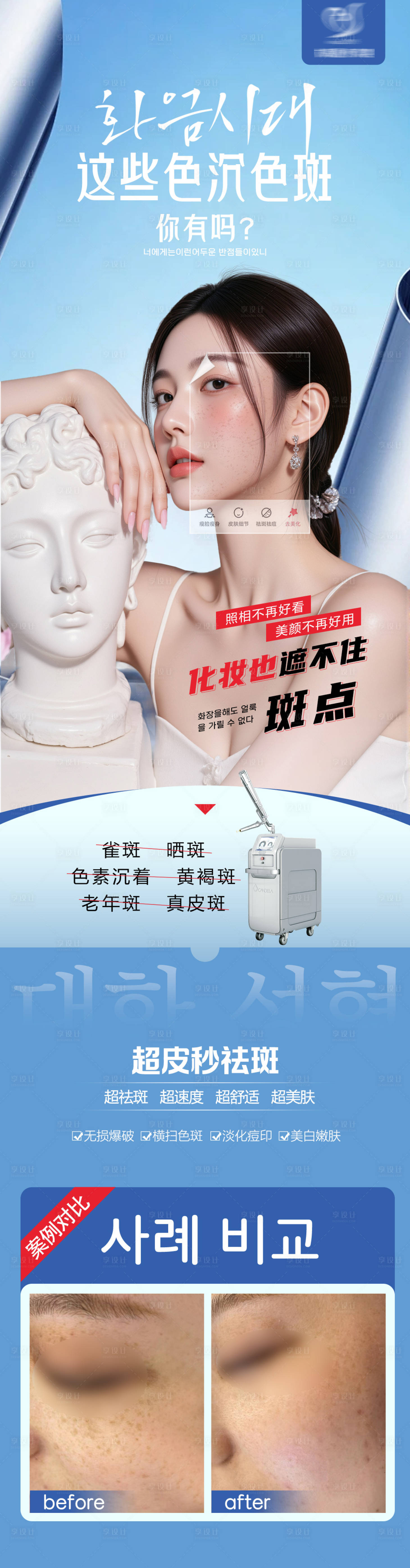 源文件下载【享设计】搜索编号：59400031947513444【超皮秒祛斑长图】