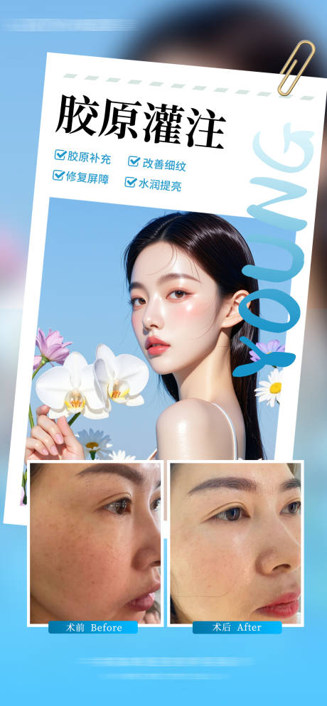 源文件下载【医美胶原灌注补水案例海报】编号：26650031914892494