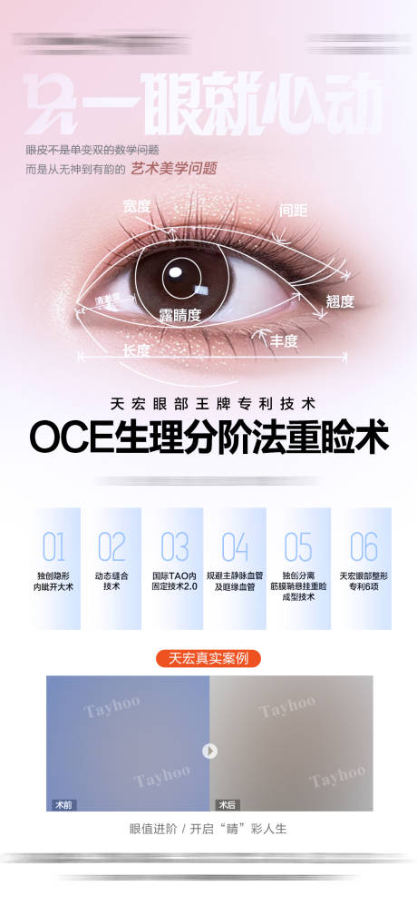 源文件下载【享设计】搜索编号：71580031898523349【双眼皮重睑术】