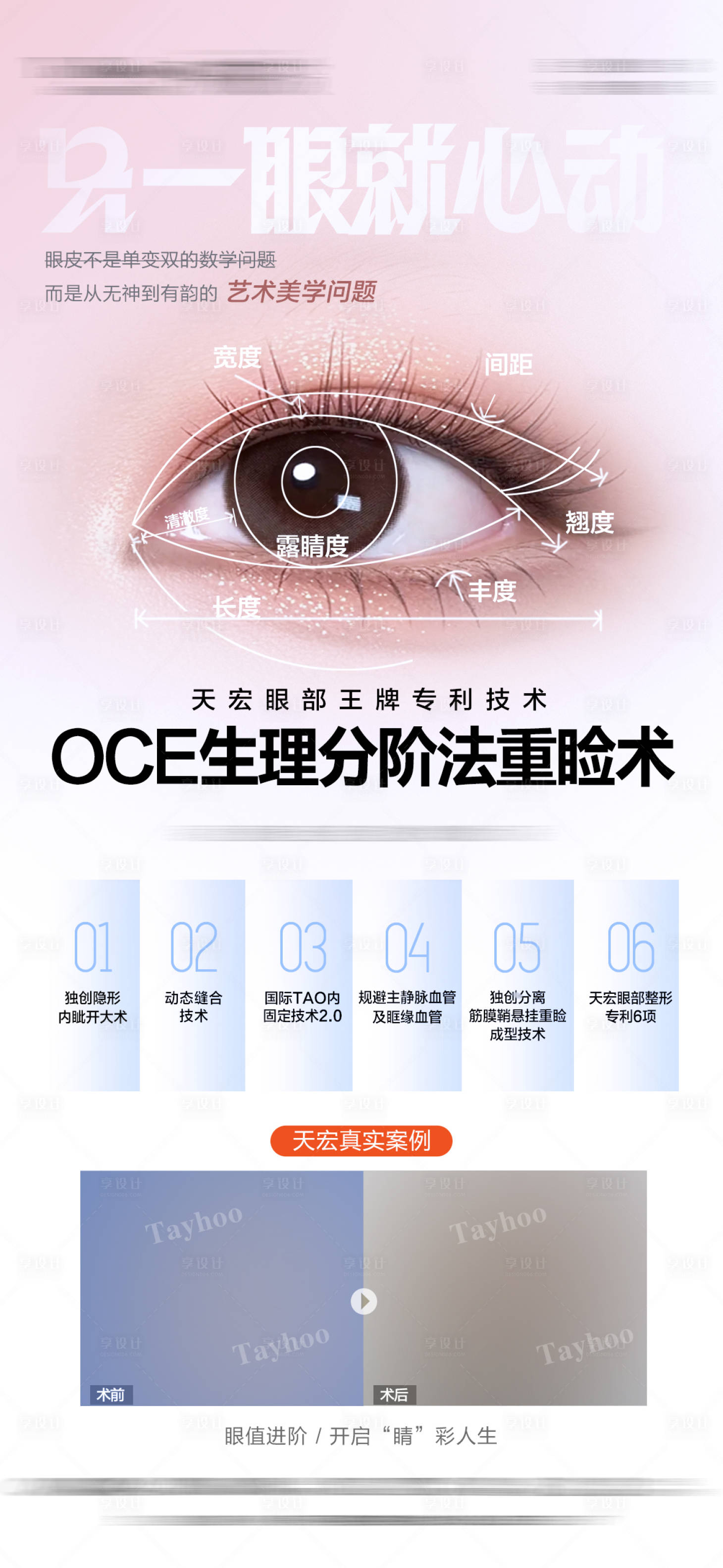 源文件下載【享設計】搜索編號：71580031898523349【雙眼皮重瞼術】