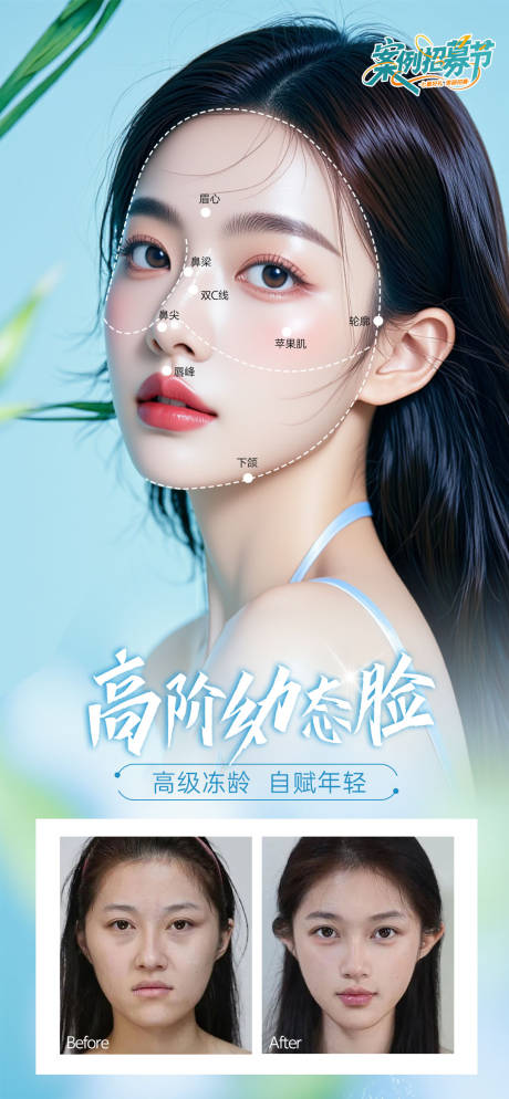 源文件下載【幼態(tài)臉醫(yī)美宣傳海報】編號：92630032150508146