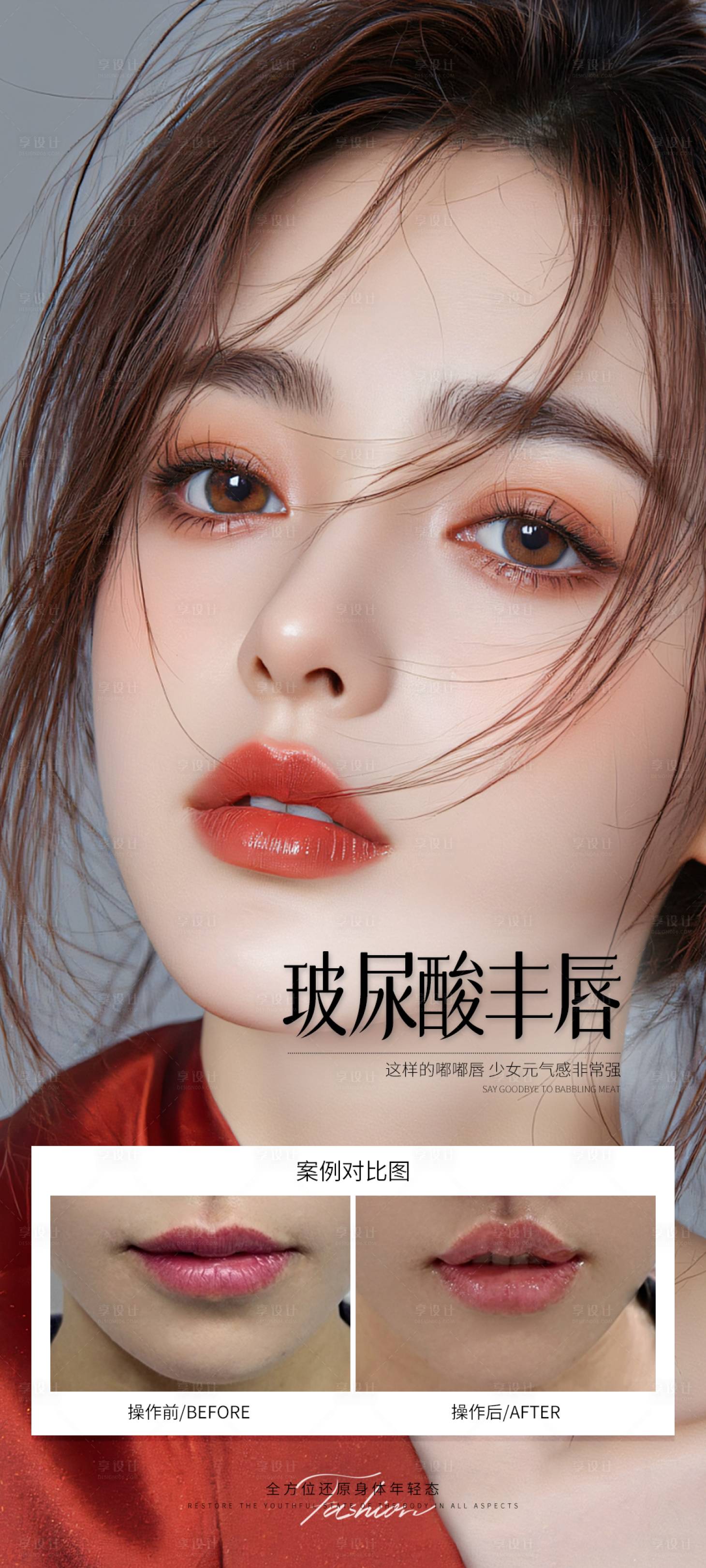 源文件下载【享设计】搜索编号：33980032258982762【玻尿酸丰唇案例海报】