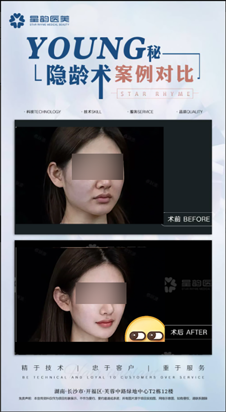 源文件下載【享設計】搜索編號：69450032185552946【醫美案例視頻框】