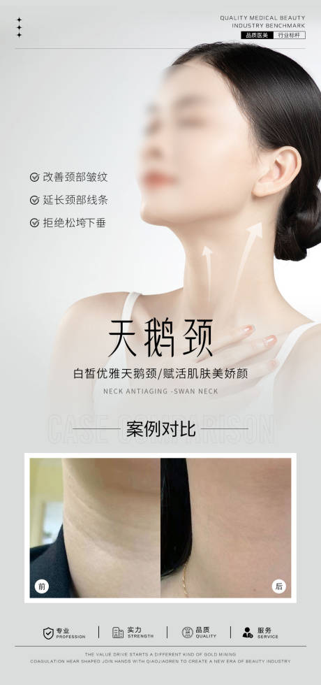 天鹅颈案例海报