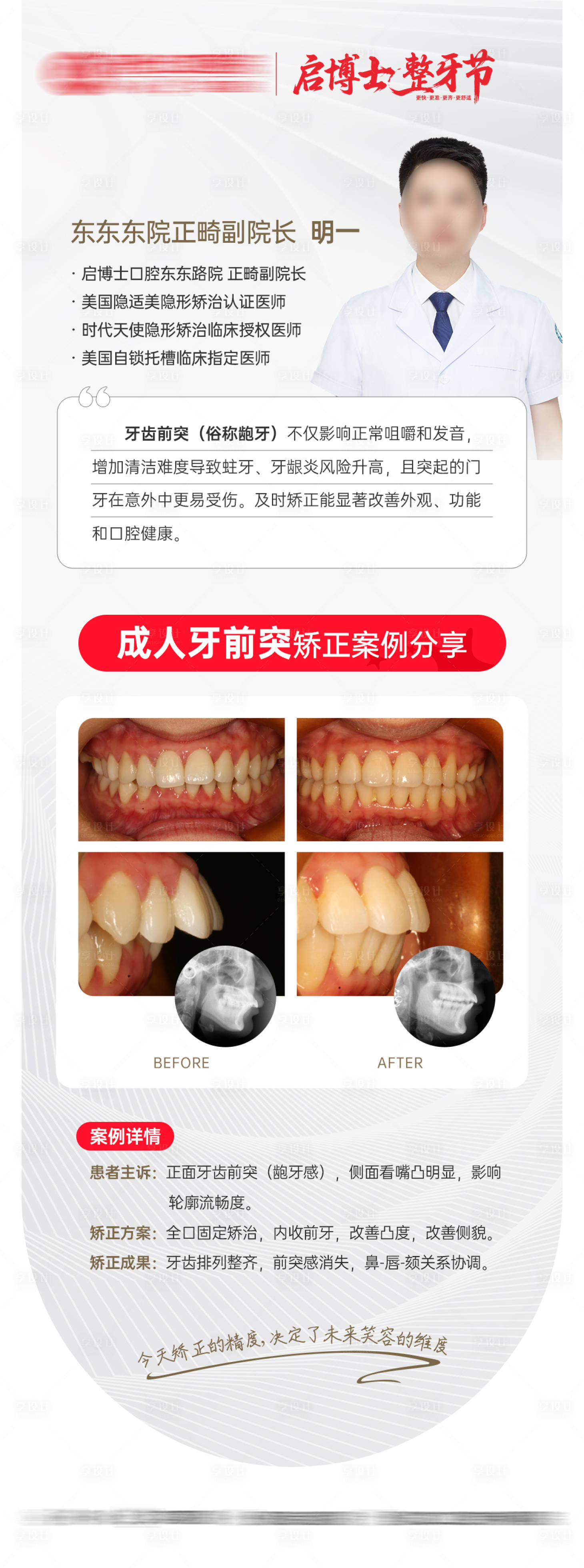 源文件下载【享设计】搜索编号：62360032044541543【正畸节日整牙龅牙案例海报】