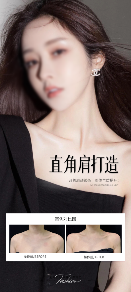 源文件下载【直角肩打造】编号：72430031979611155