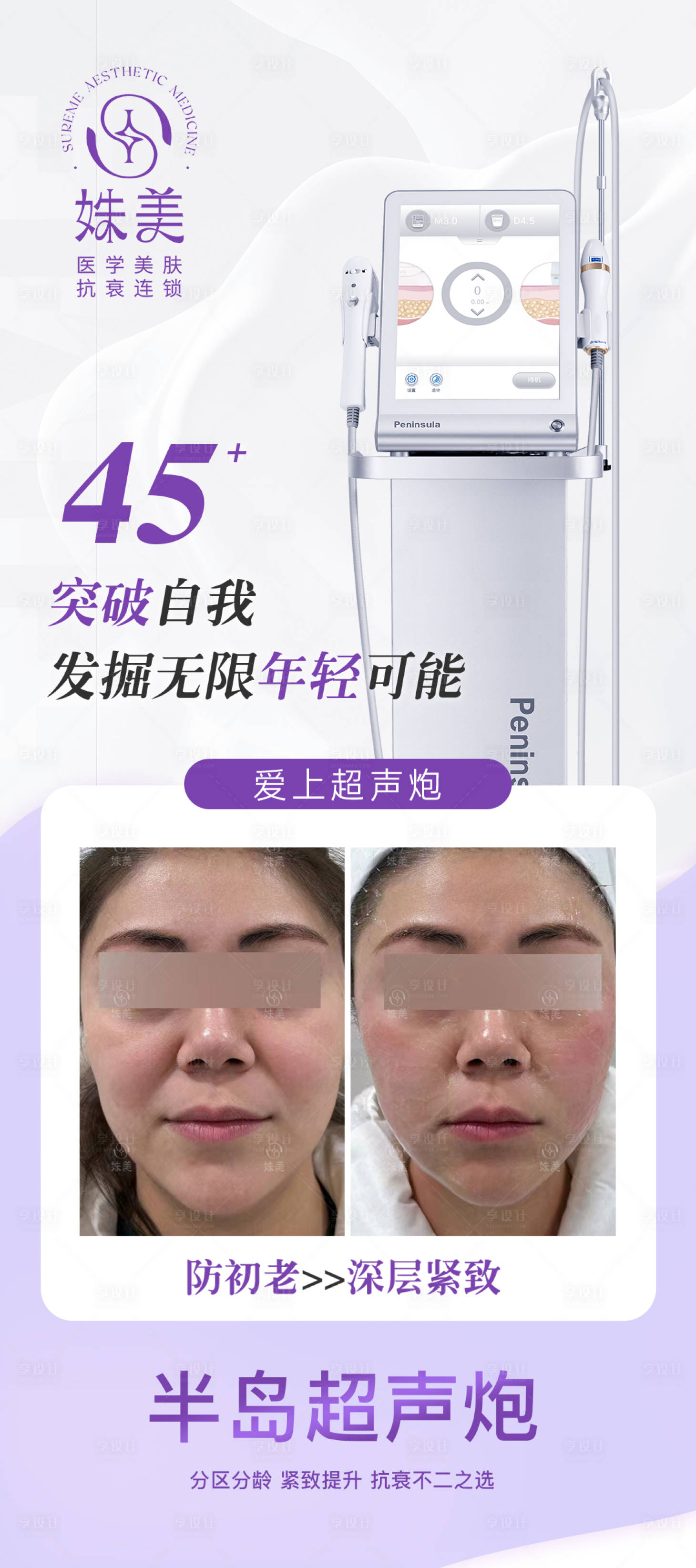 源文件下載【享設計】搜索編號：55530032205252911【醫美超聲炮案例】