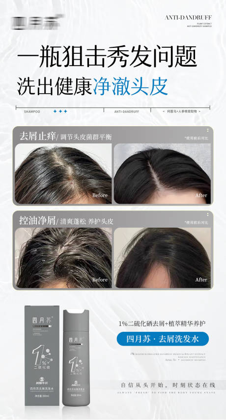 源文件下載【去屑洗發水使用效果對比海報】編號：15750031907243763