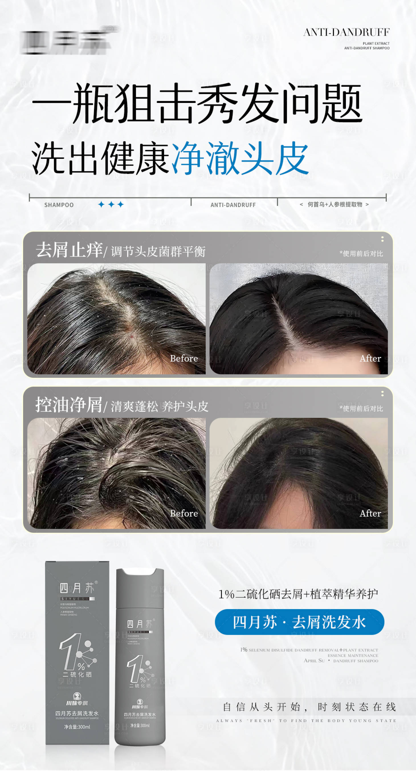 源文件下载【去屑洗发水使用效果对比海报】编号：15750031907243763