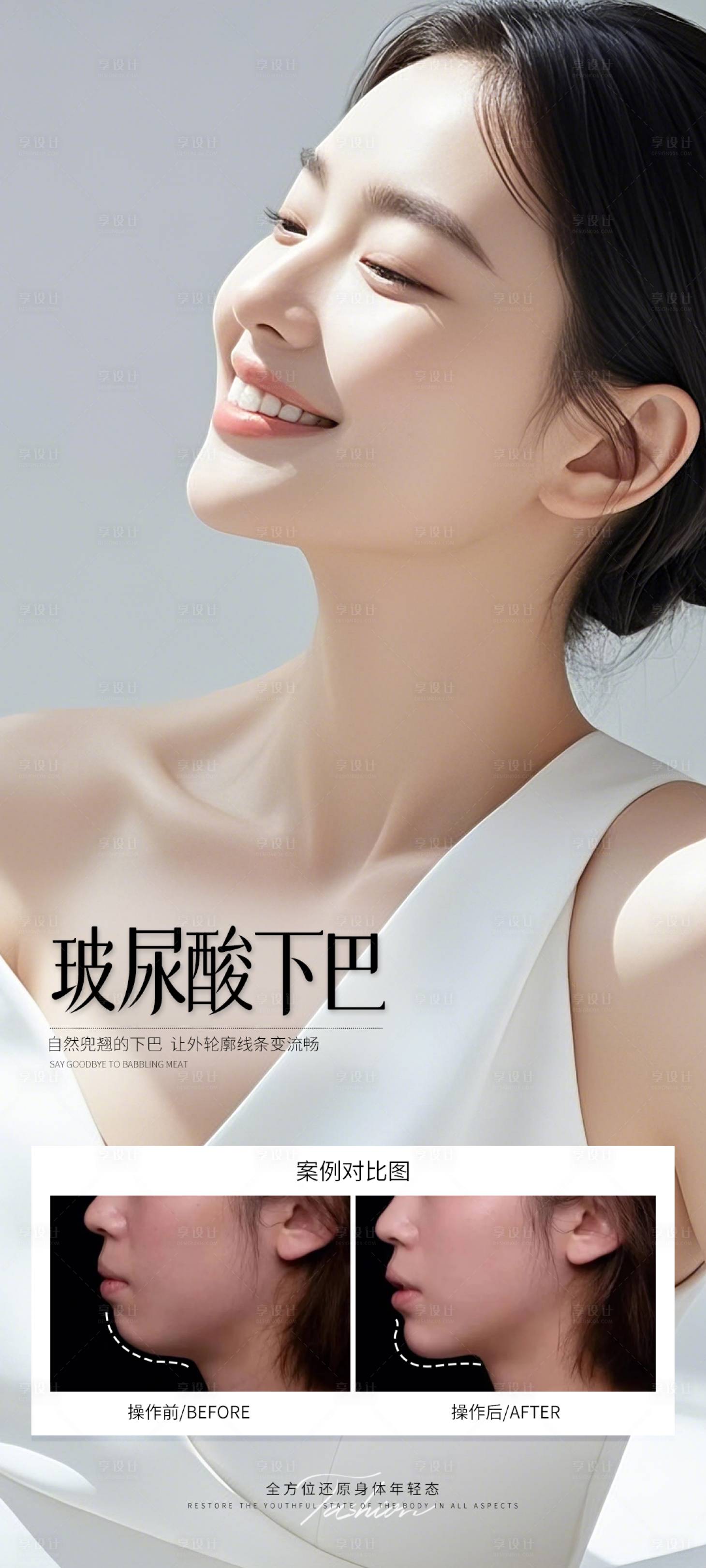 源文件下載【享設計】搜索編號：45190032258586693【玻尿酸下巴案例】