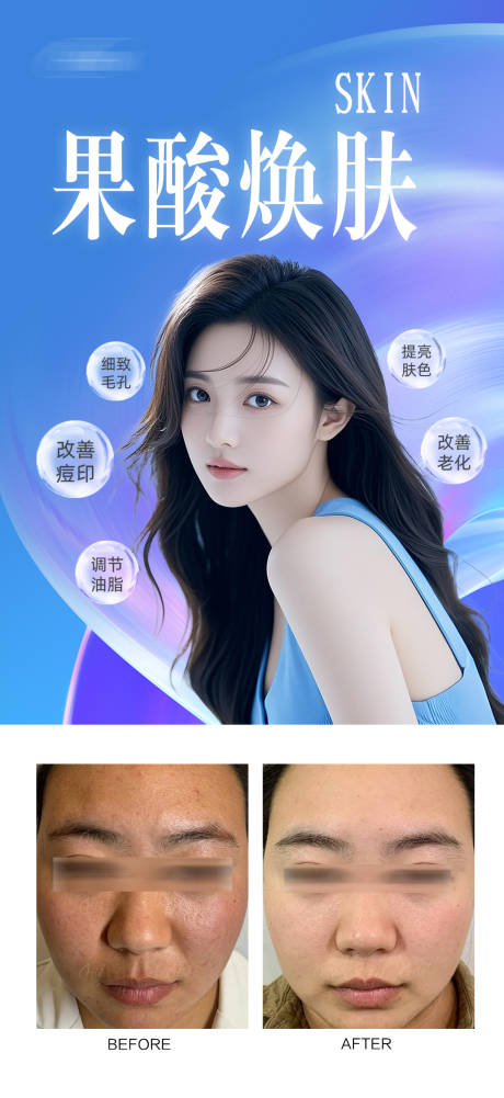 源文件下载【享设计】搜索编号：42620031943234214【果酸焕肤案例】
