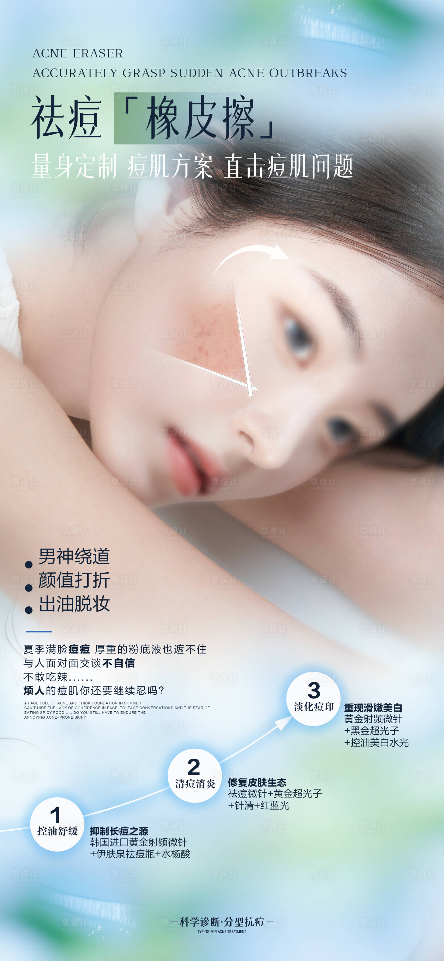 源文件下载【享设计】搜索编号：93110032160205045【医美祛痘海报】