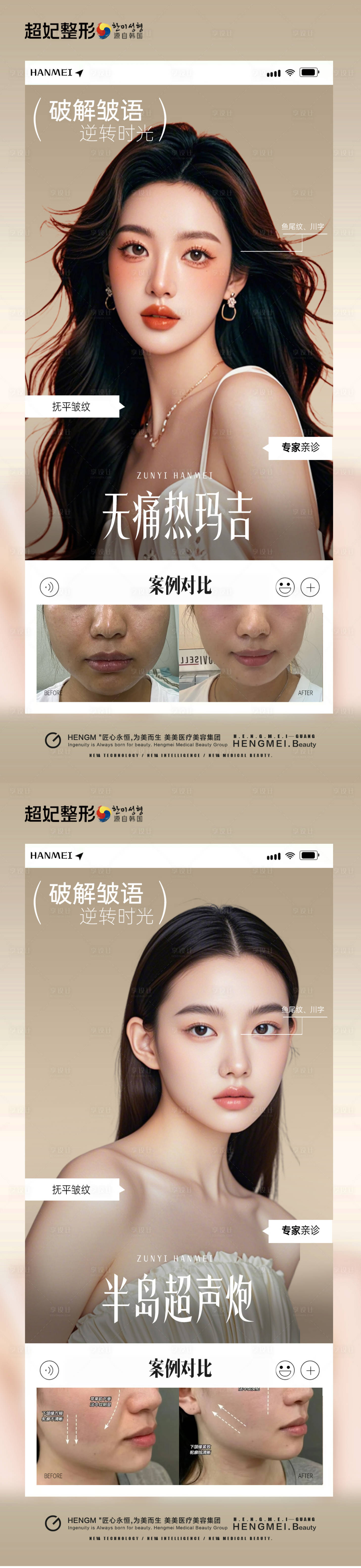 源文件下載【享設計】搜索編號：50030031665534902【抗衰案例對比海報】