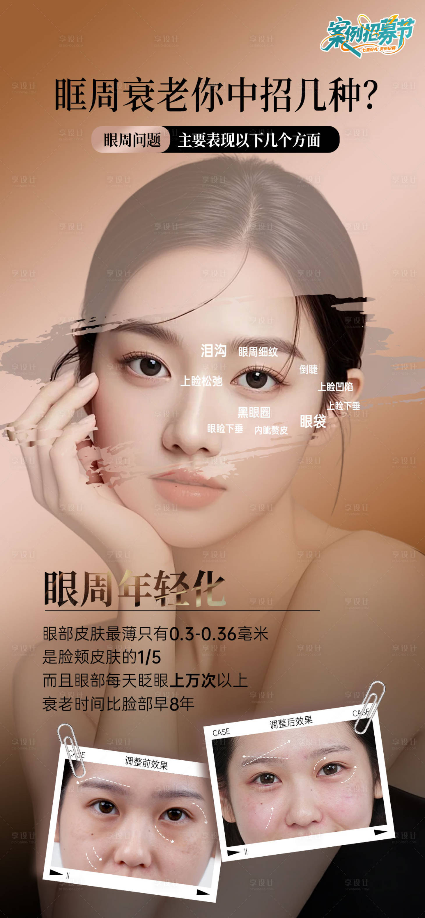 源文件下载【眼周抗衰海报】编号：34620032152986057