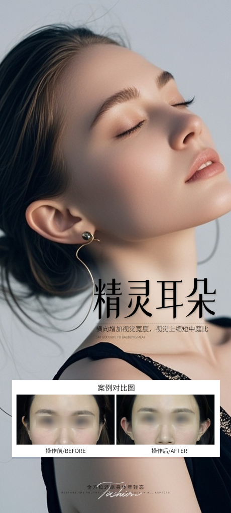源文件下載【精靈耳朵案例對比人物海報】編號：21290031901792680