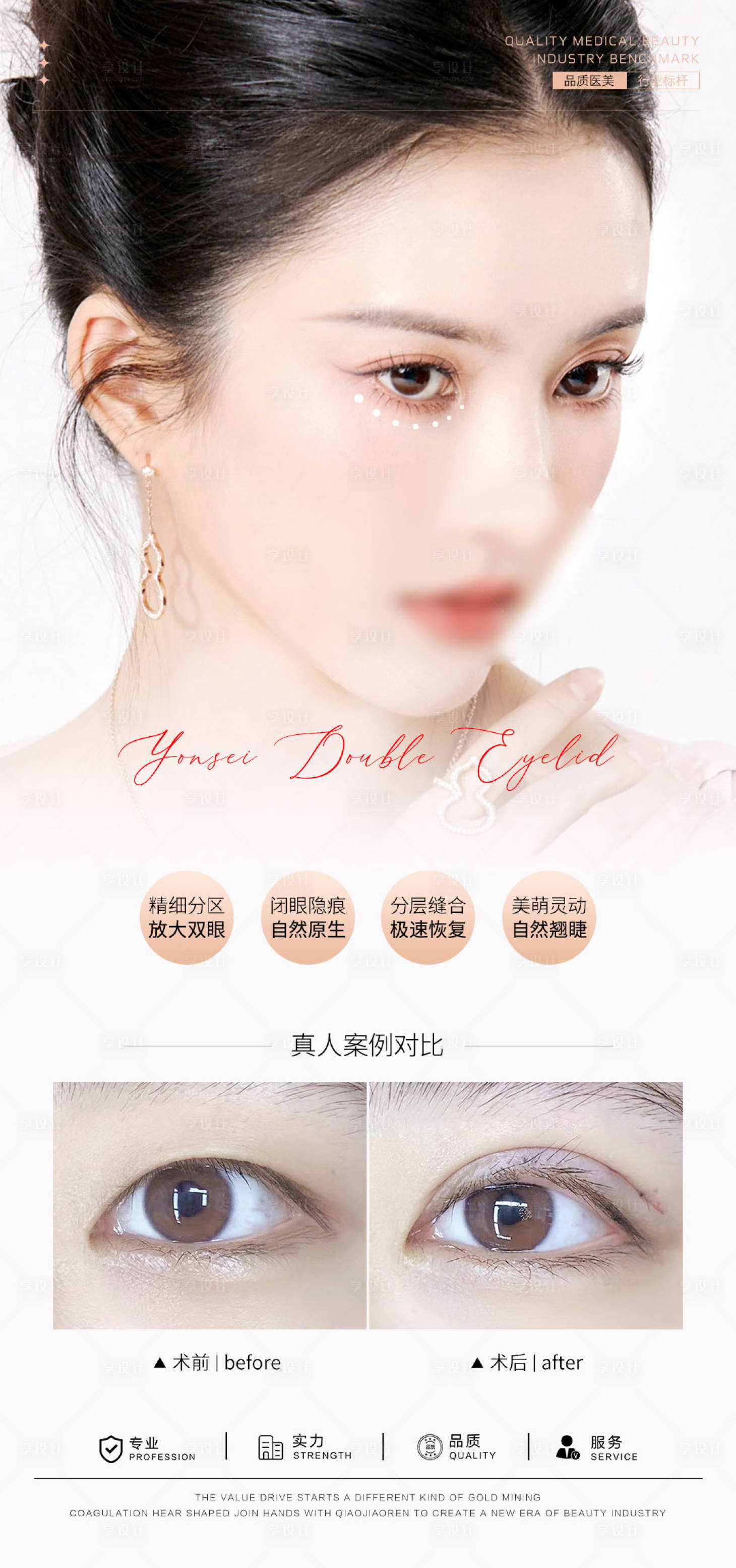 源文件下载【享设计】搜索编号：31320031791562878【双眼皮案例海报】