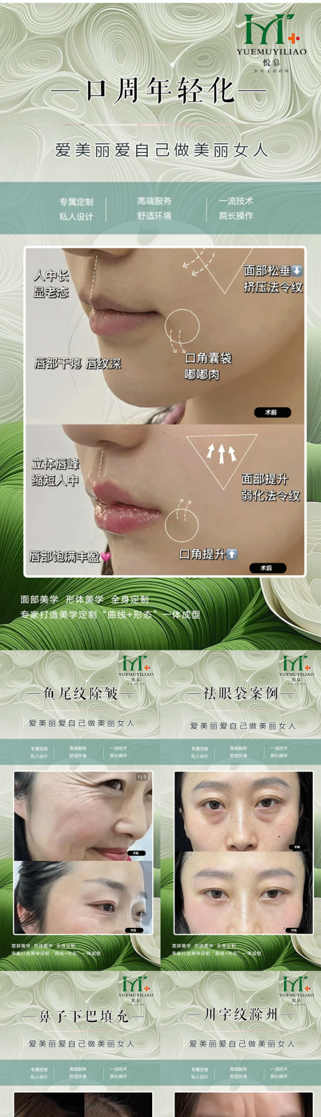源文件下载【医美案例】编号：33770032056034236