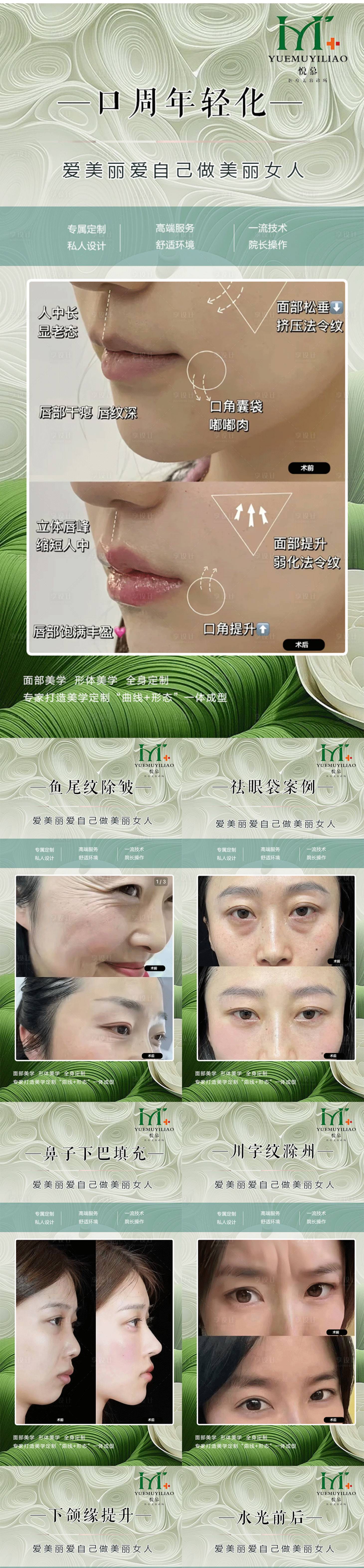 源文件下载【享设计】搜索编号：33770032056034236【医美案例】