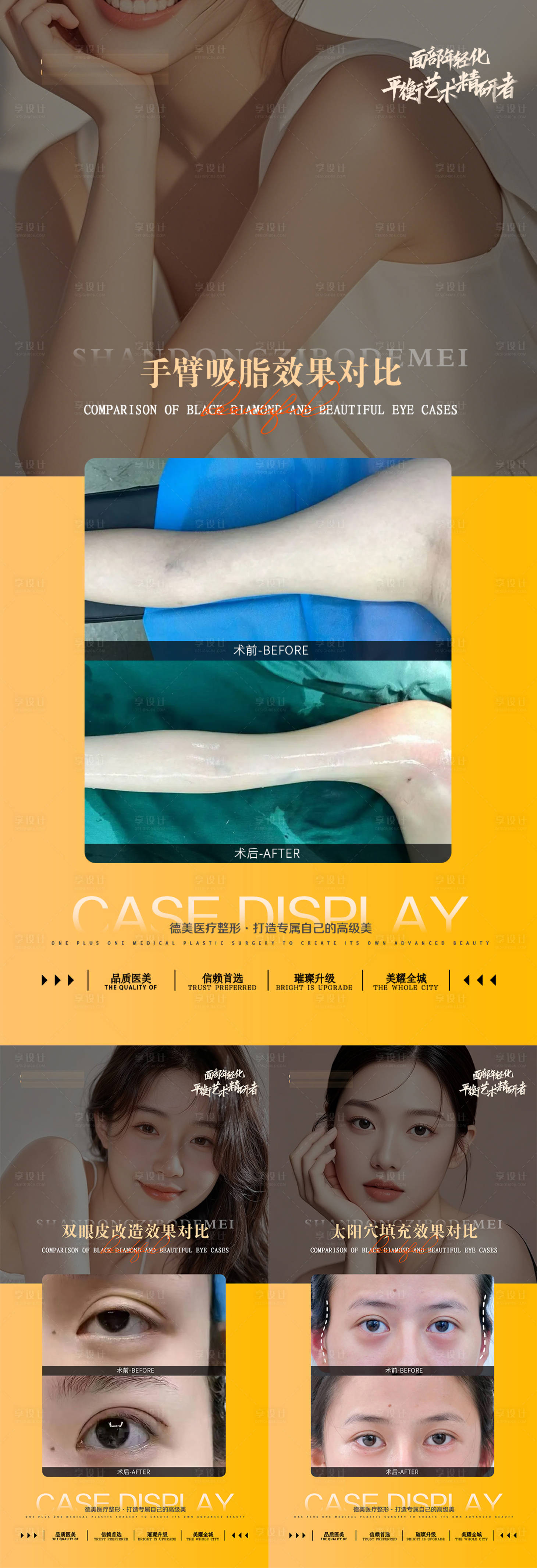 源文件下载【享设计】搜索编号：55520031957068248【整形案例对比】