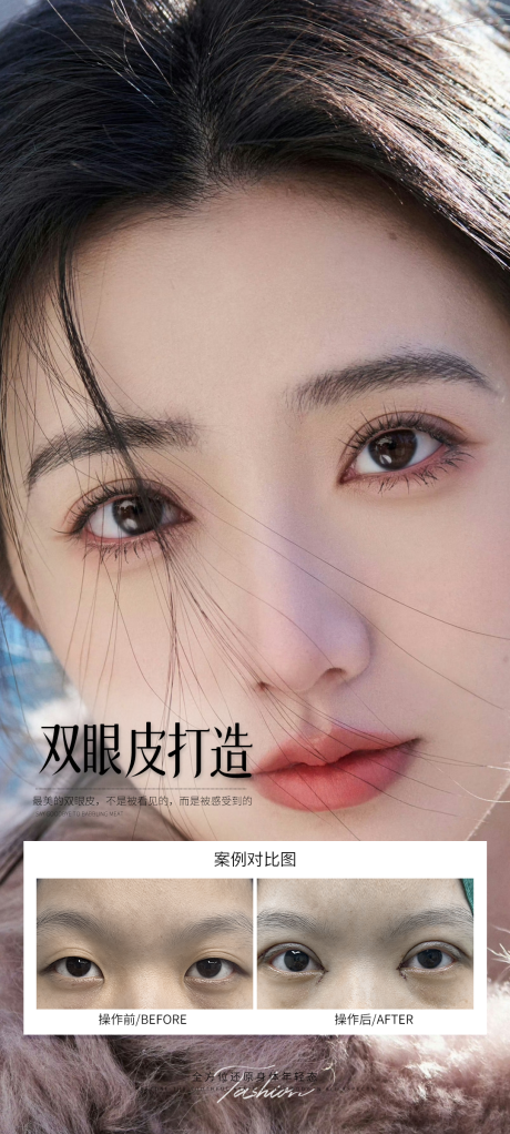 源文件下載【雙眼皮打造案例海報】編號：63190031814234744
