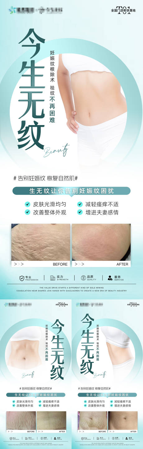源文件下载【享设计】搜索编号：33730032774993858【妊娠纹对比系列海报】