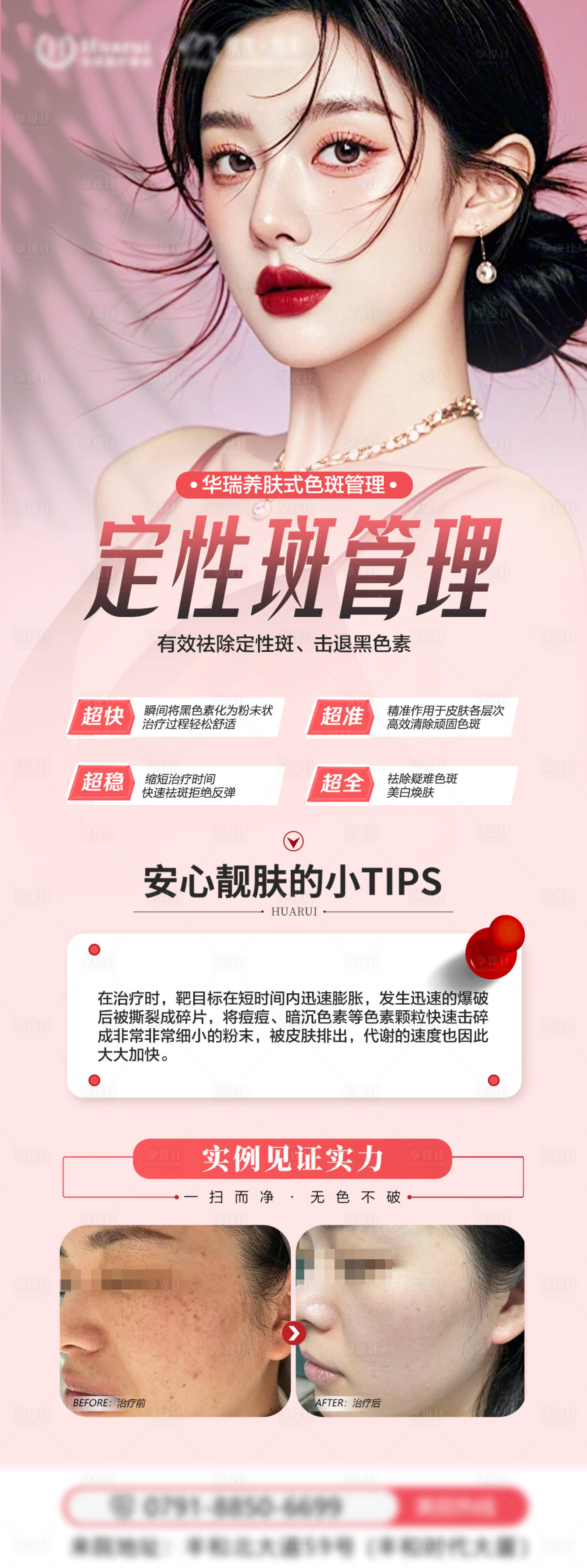源文件下载【享设计】搜索编号：81910032394661550【医美品项宣发海报】