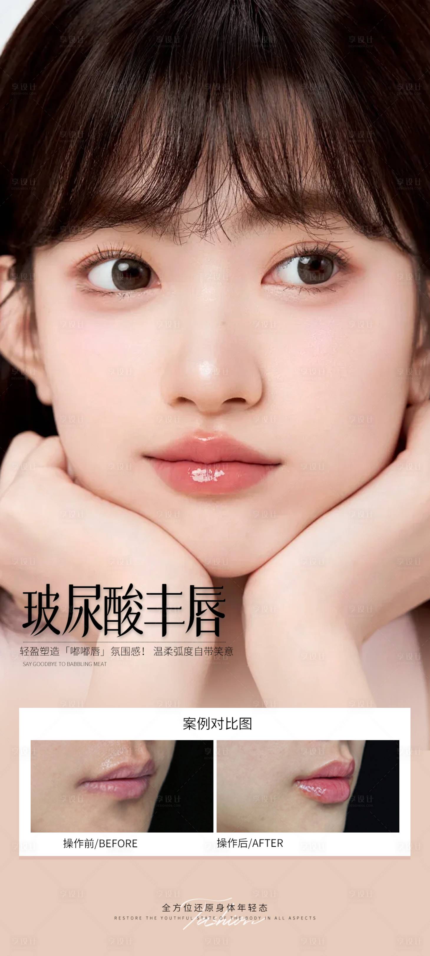 源文件下载【享设计】搜索编号：15290032280316314【玻尿酸丰唇案例海报】