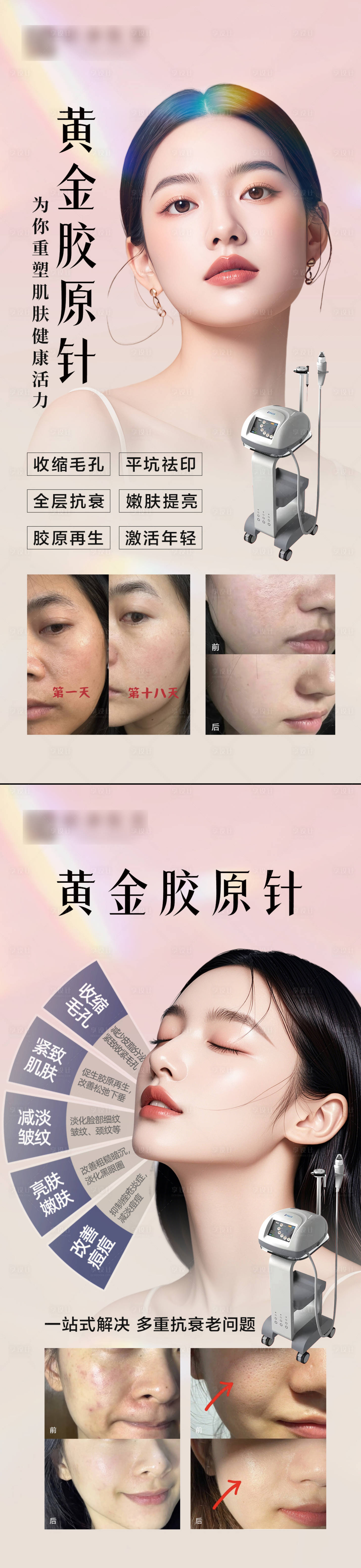 源文件下载【享设计】搜索编号：38640032448856492【黄金微针海报】