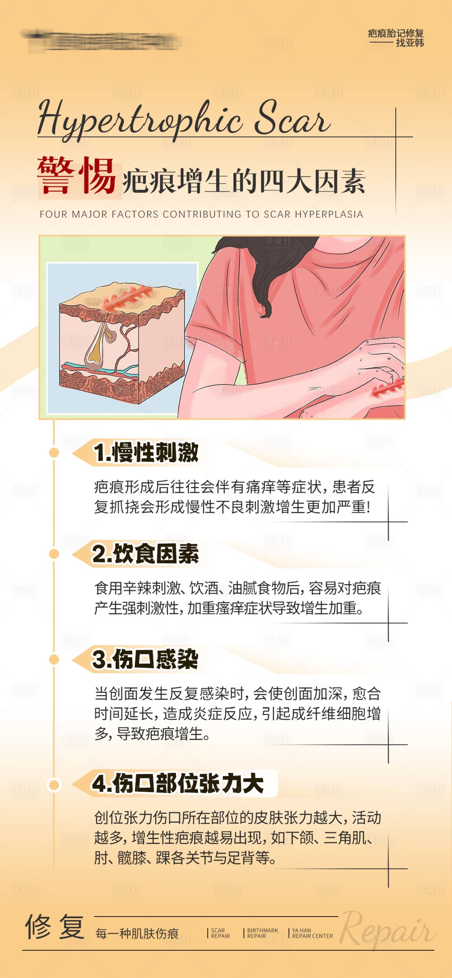 源文件下載【享設計】搜索編號：39700032427727848【警惕疤痕增生的四大因素】