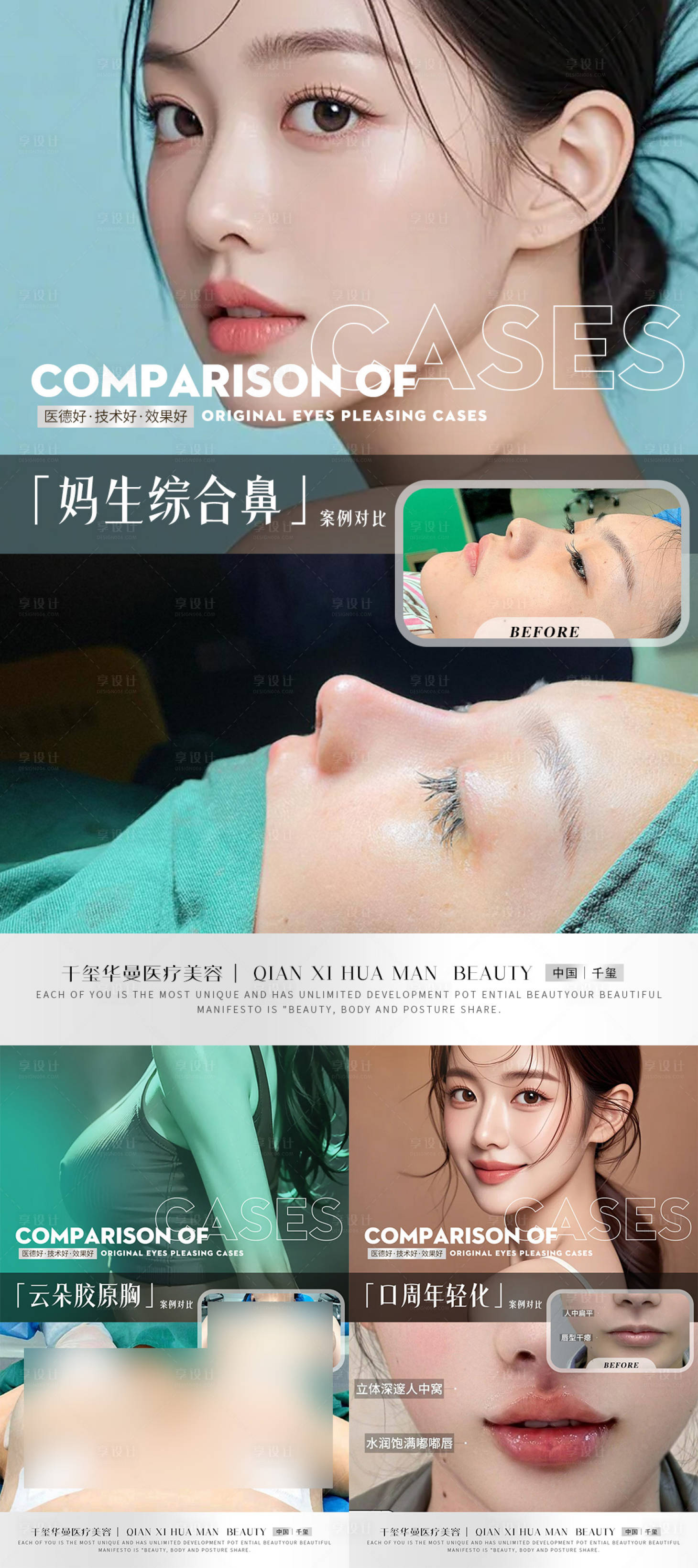 源文件下载【享设计】搜索编号：11990032779794465【高级整形案例海报】