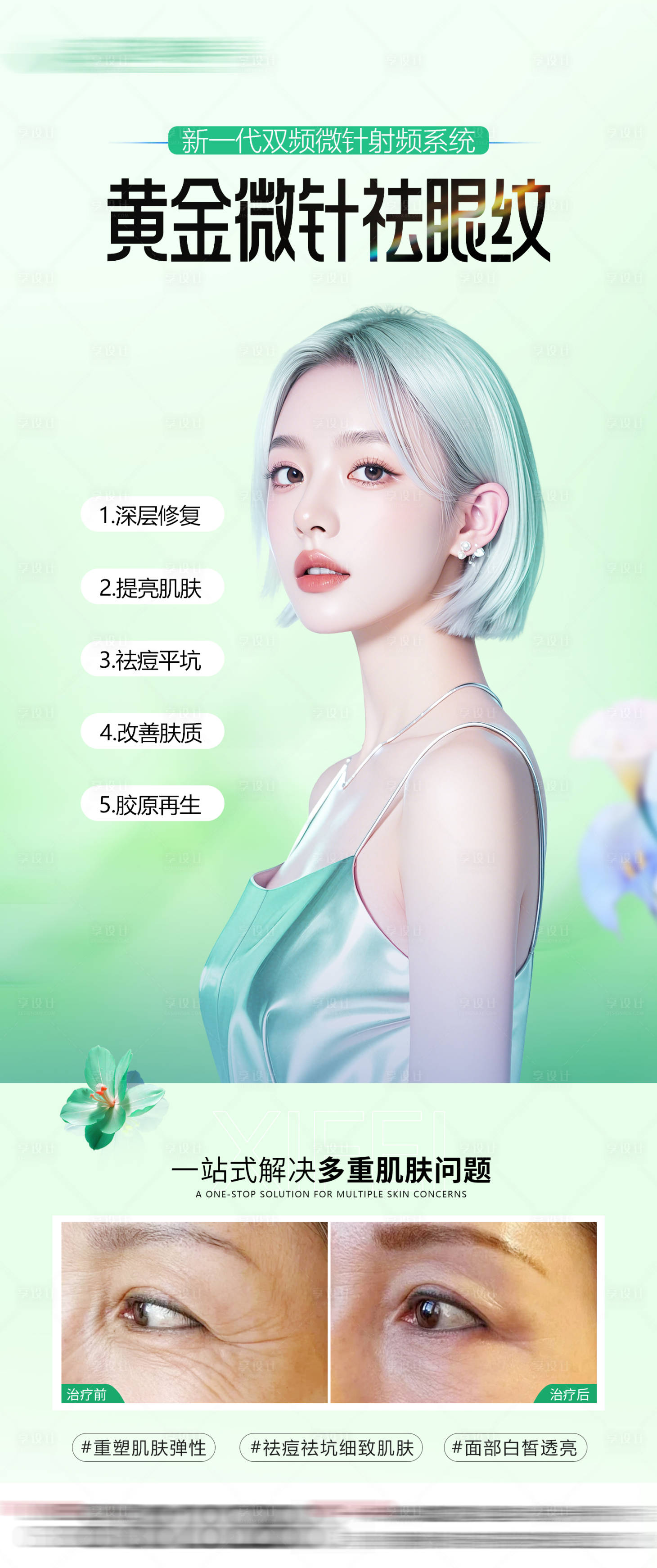 源文件下載【享設計】搜索編號：81050032635969061【黃金微針案例】