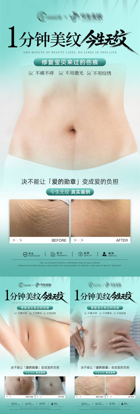 源文件下载【享设计】搜索编号：42560032654035196【妊娠纹对比海报】