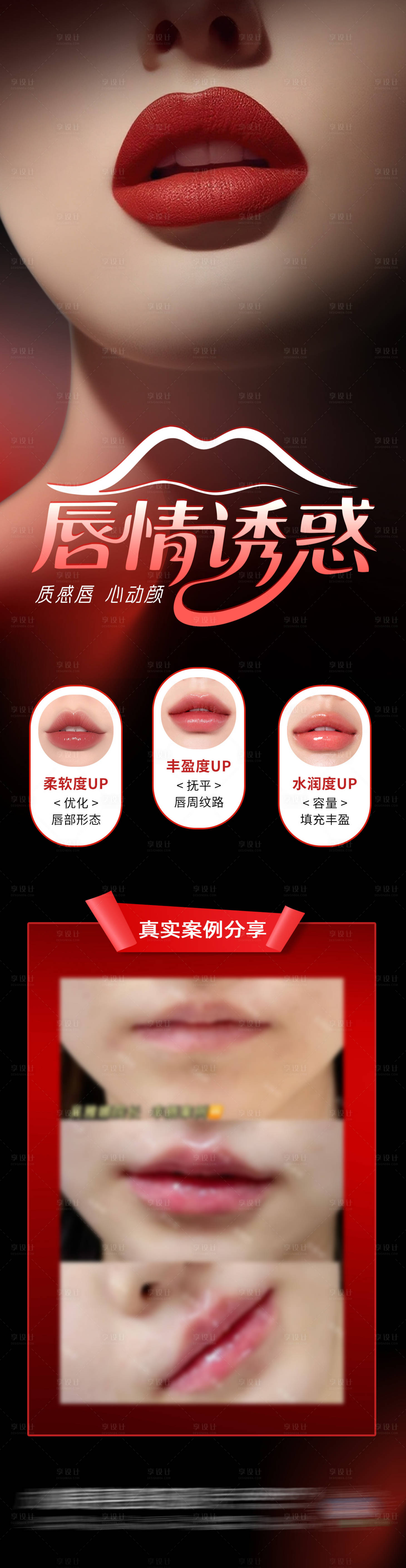 源文件下載【享設計】搜索編號：18060032457288891【醫美玻尿酸唇部塑形案例紅黑創意海報】