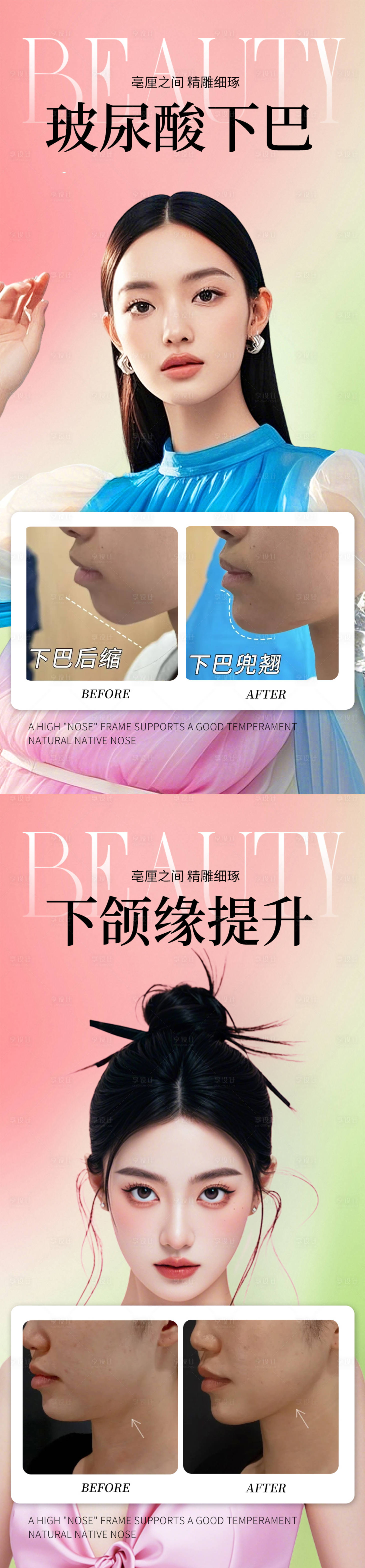 源文件下载【享设计】搜索编号：82310032462341530【微整案例】
