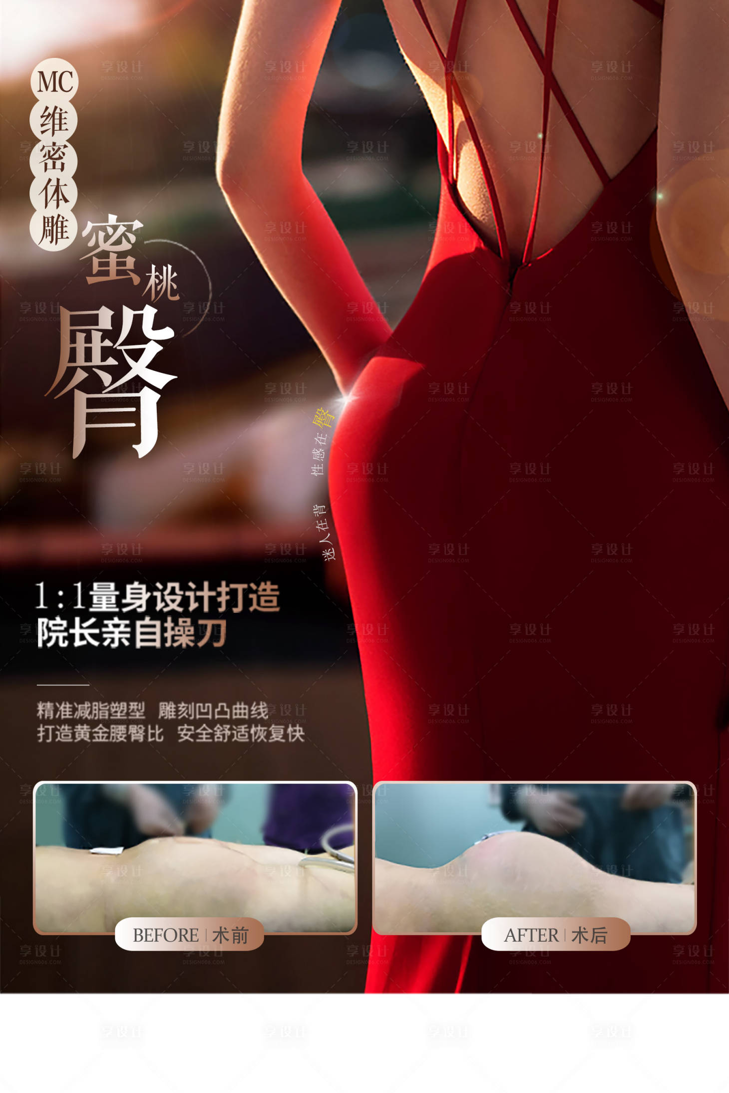 源文件下载【享设计】搜索编号：81690032645805903【医美蜜桃臀案例对比海报展板】