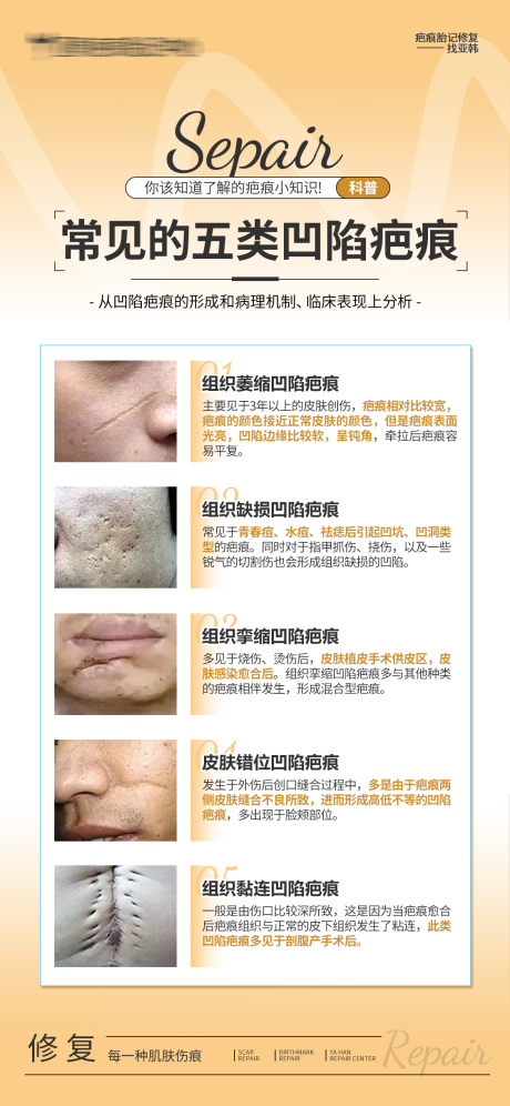 源文件下載【享設計】搜索編號：82510032436441550【常見的五類凹陷疤痕】