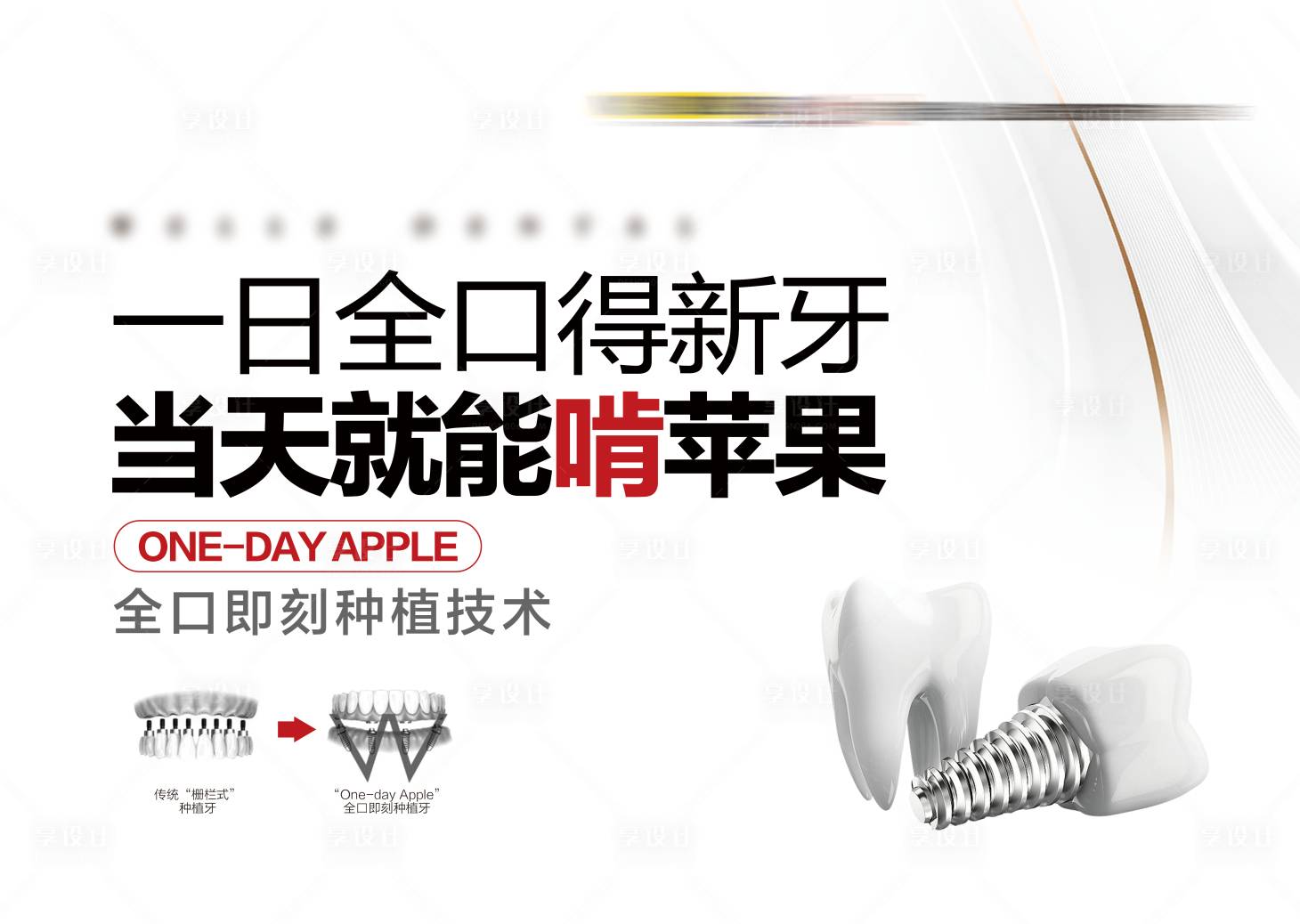 源文件下载【享设计】搜索编号：50370032369324123【种植活动半口种植科普灯箱】