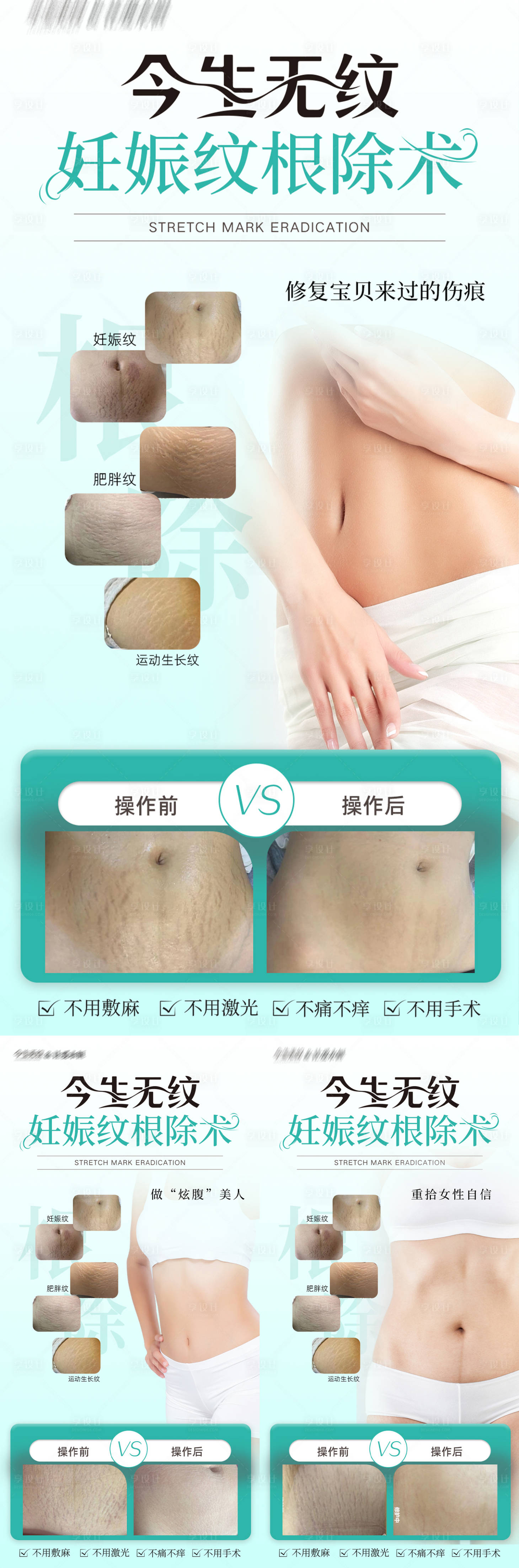 源文件下載【享設計】搜索編號：69290032654333532【妊娠紋對比系列海報】
